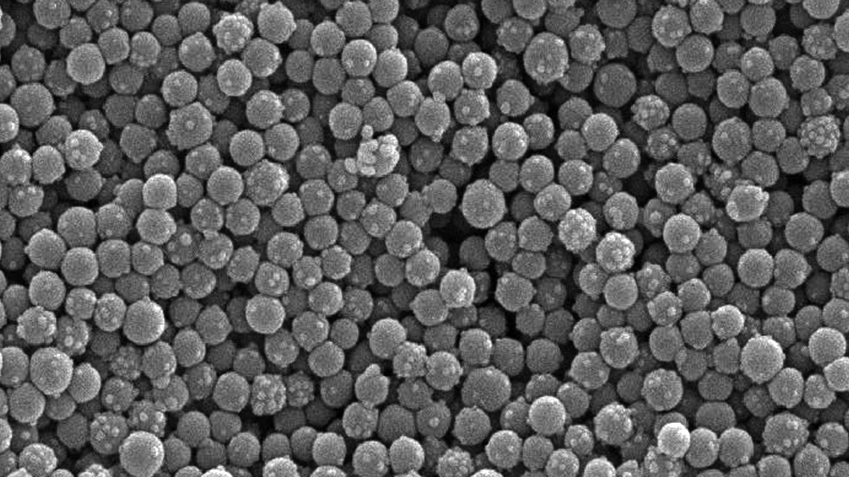 ZVO-Oberflächentage 2021: Das Vortragsprogramm – Teil 2 – Edelmetalloberflächen, Prozessüberwachung, Normen