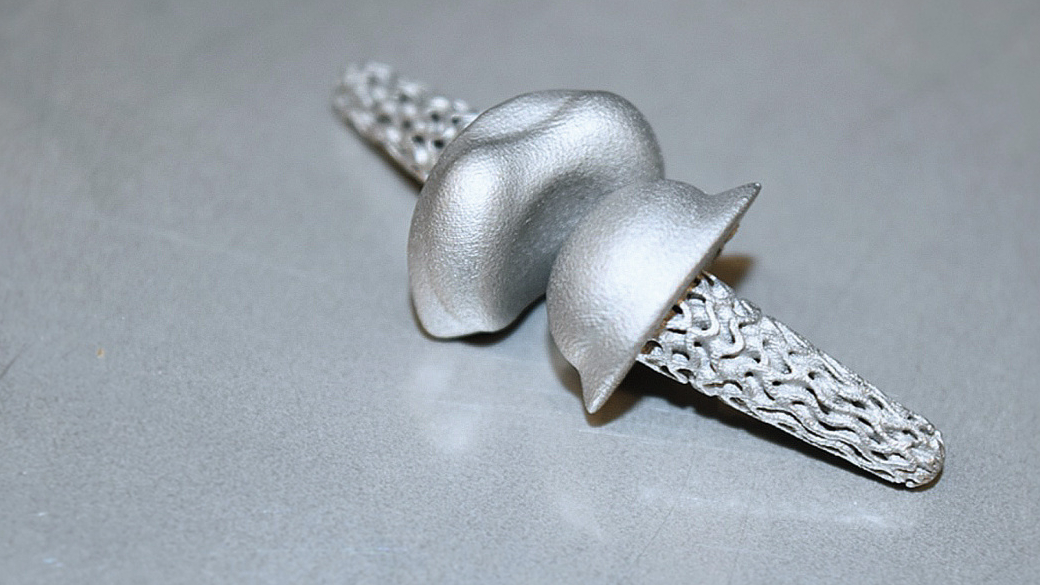 Individualisierte Fingergelenksimplantate aus dem 3D-Drucker