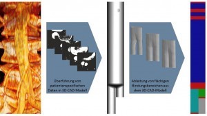 Abb. 1: Überführung von Computertomographie-Datensätzen in ein 3D-CAD-Modell zur Ableitung von flächigen Bindungsbereichen für die webtechnische Umsetzung