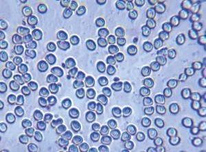 Abb. 6: Menschliche Blutzellen, abgebildet mit Diple und einem iPhone 