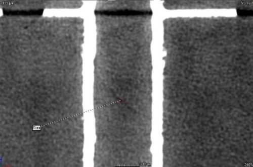 Abb. 9: CT-Röntgenanalyse von passiv verfüllten Buried Vias: Exemplarisches Beispiel für einen Riss in einem Buried Via (Reihe 2, zweites Buried Via von links in der Abb. 8)