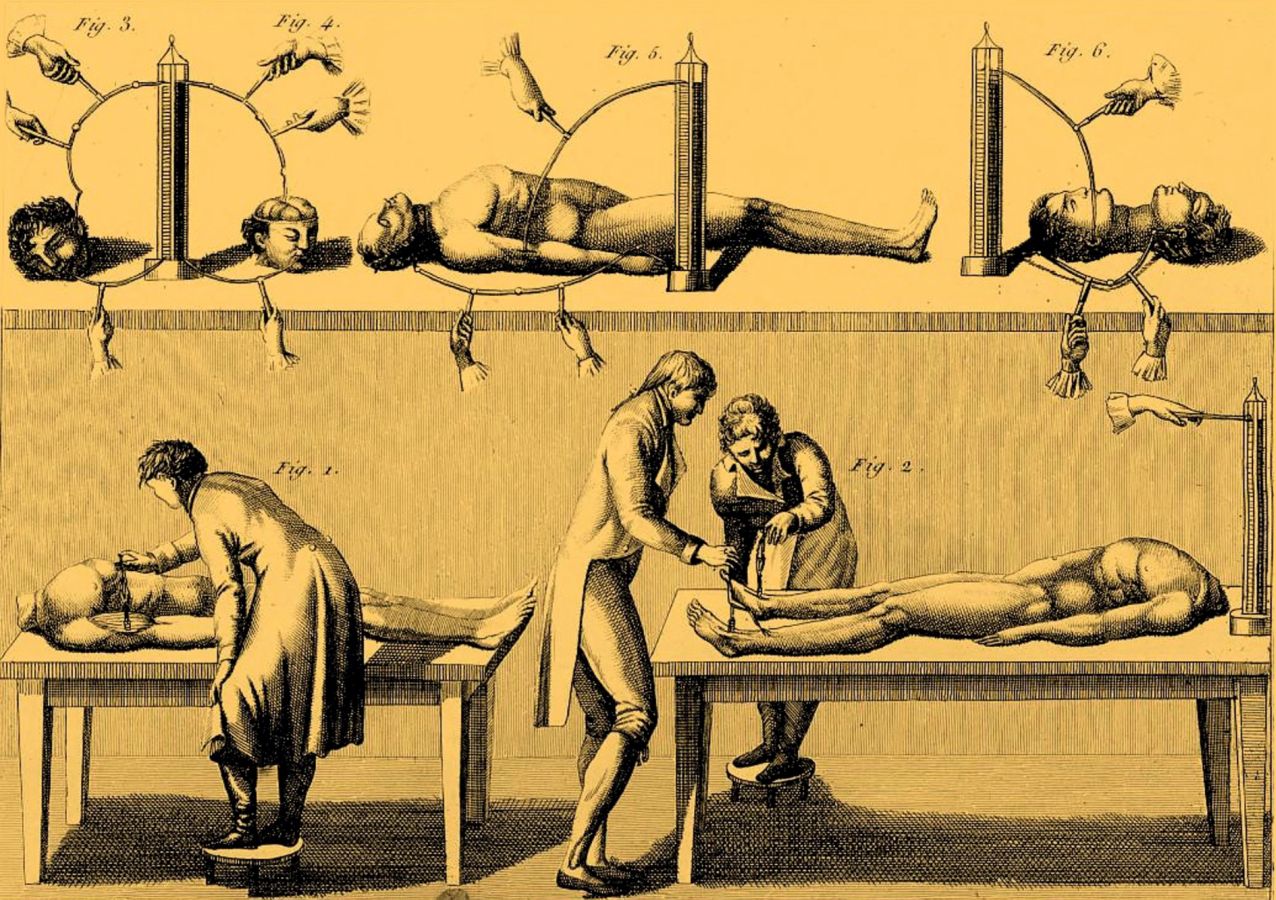 Galvanische Labore müssen in Zeiten der Romantik wahre Horrorschuppen gewesen sein. Man experimentierte mit Amphibien, Säugetieren und, ja, wenn man eine menschliche Leiche bekommen konnte, auch an jener. Ritter holte sich regelmäßig amputierte Gliedmaßen aus den Krankenhäusern von Jena und der Umgebung der Stadt