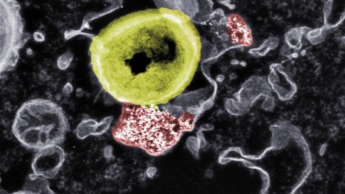 Abb. 2: Tödlicher Kontakt: Forschende der Empa und der ETH haben Nanopartikel (rot) entwickelt, die resistente Bakterien (gelb) abtöten