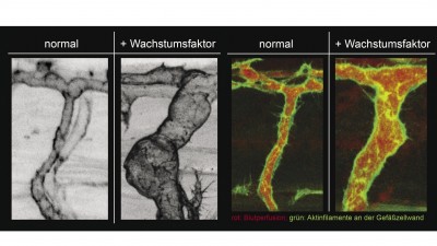Darstellung natürlich wachsender lebender Arterien und fluoreszenzmikroskopische Darstellung des Blutflusses und des endosthelialenAktin Zytoskellets