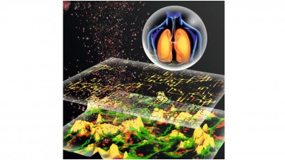 In-silico-Modellierung von Partikel-Zell-Interaktionen für die Vorhersage der Toxizität von Nanopartikeln für die Atemwege (grafische Darstellung)