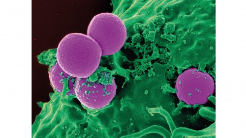 Abb. 1: Wo herkömmliche Medikamente versagen: Antibiotika-resistente Bakterien. Kolorierte elektronenmikroskopische Aufnahme