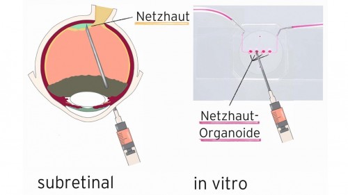 Schematische Darstellung der subretinalen Injektion unter die Netzhaut und in den in vitro Organ-Chip