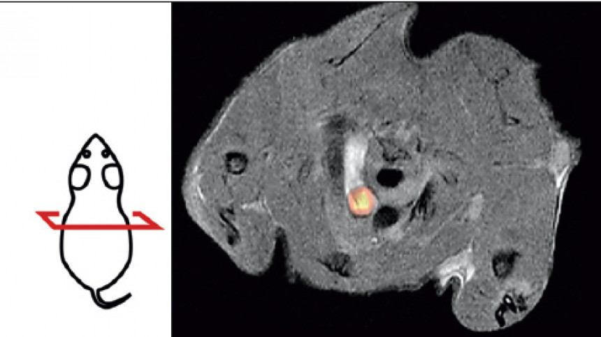 PET/MRT Aufnahme einer Maus mit Gefäßverkalkung. Der Aortenbogen ist die helle Struktur im Zentrum, gelb leuchten potentiell gefährliche Gefäßmuskelzellen. Links: Schnittebene des PET/MRT-Fotos