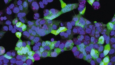 Das Bild zeigt Zellen, in die das Gen für einen grünen Farbstoff eingebracht wurde. Bei Beleuchtung wird die mRNA-Bauanleitung des Farbstoffs nicht abgebaut. Die Zellen leuchten daher grün 