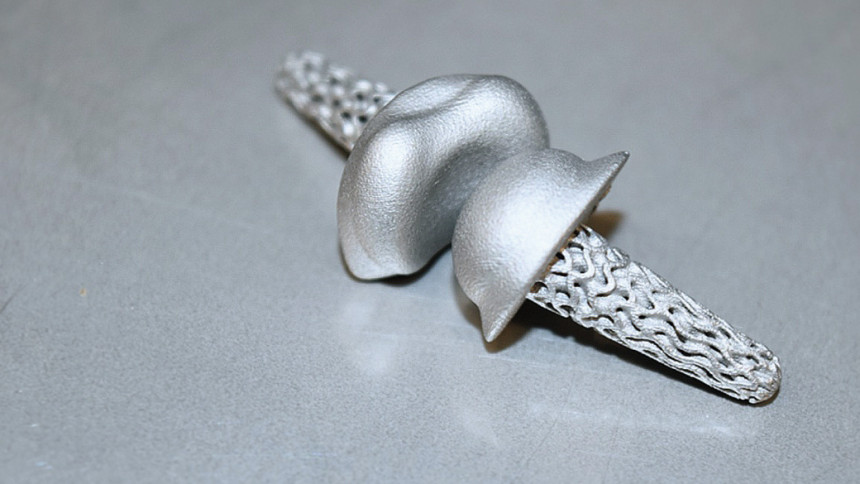 3D-Druck-Verfahren gefertigtes FingerKIt-Implantat
